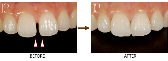 Case2_1